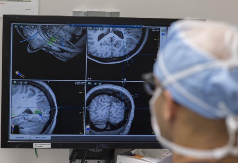 Neurosurgery Laser Ablation Surgery for Epilepsy Texas Children’s